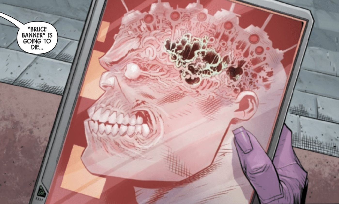 Escaneamento do cérebro do Hulk Bruce Banner provocação da morte